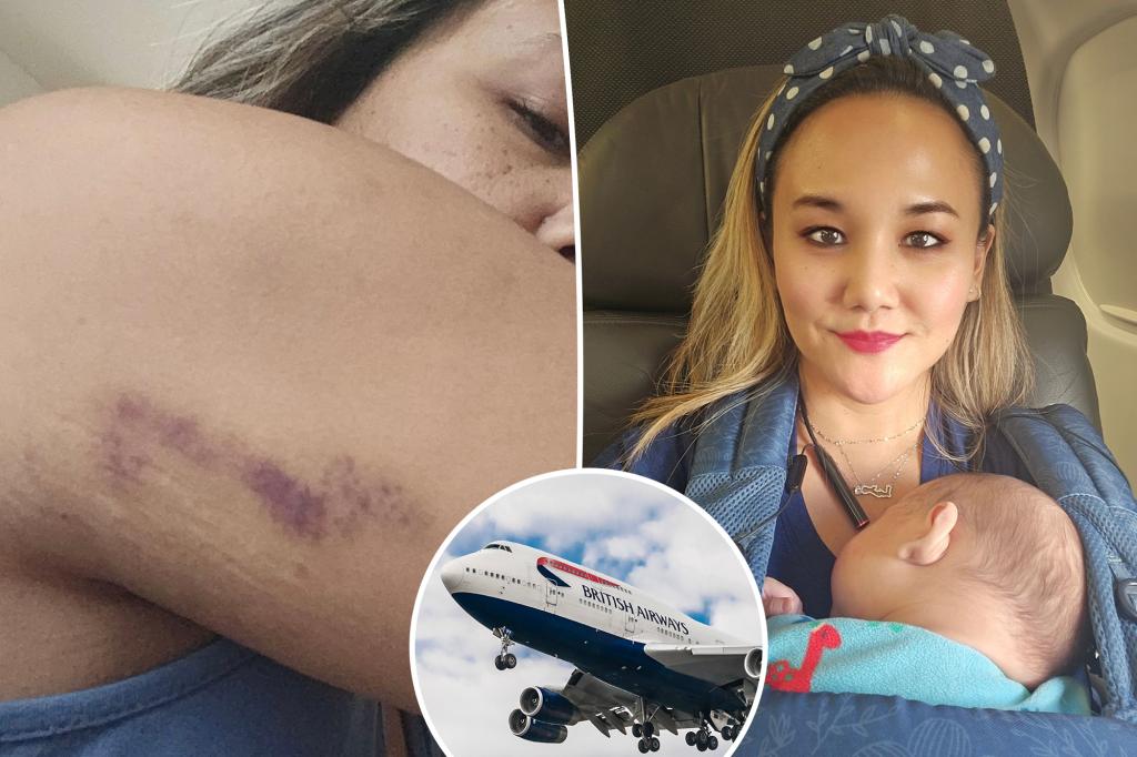 I was bumped and bruised on my hellish trip overseas - it was the worst airplane experience of my life